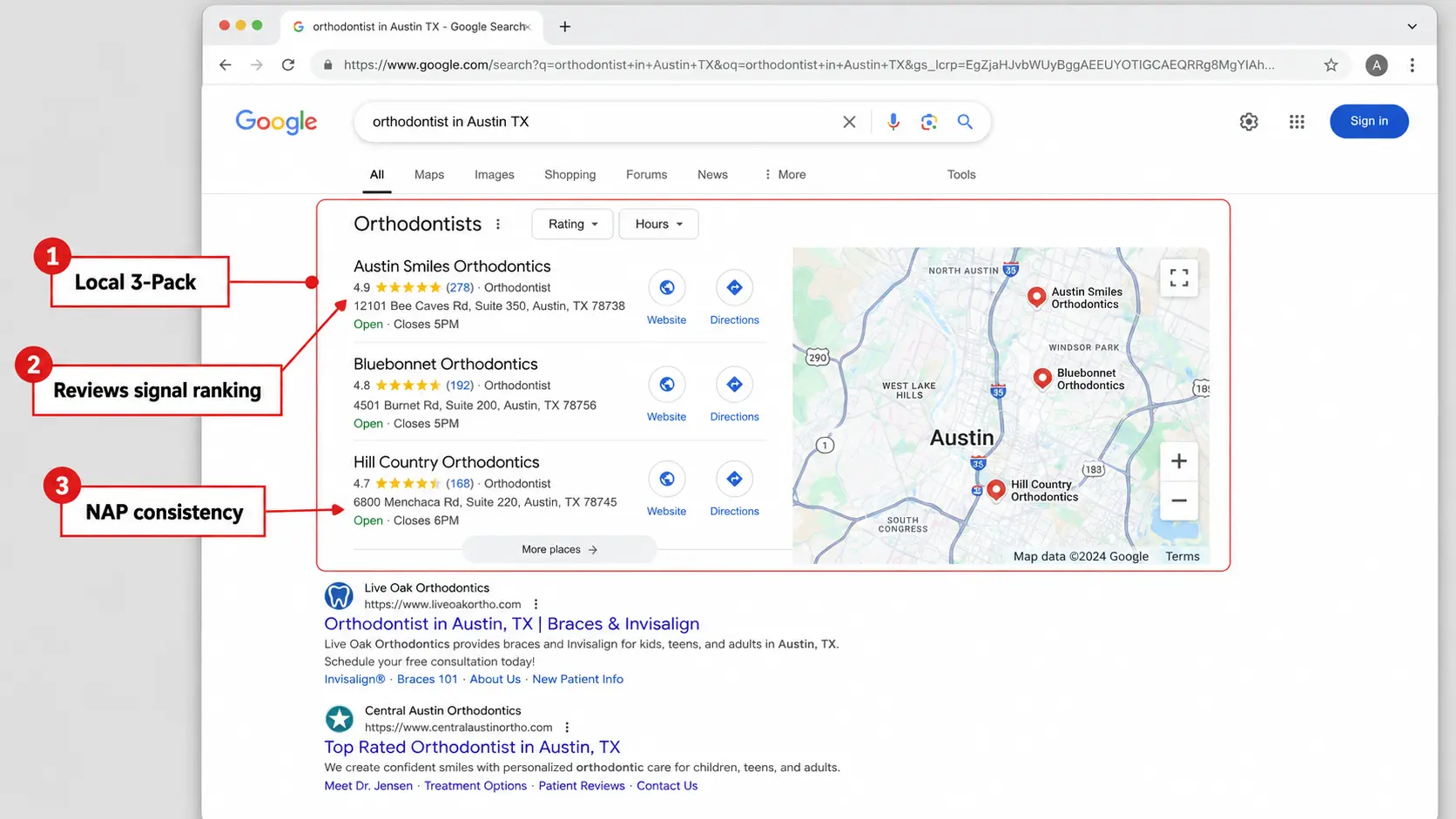 A Google search results page for “orthodontist in Austin TX” highlights the local 3-pack, review signals, and address consistency.